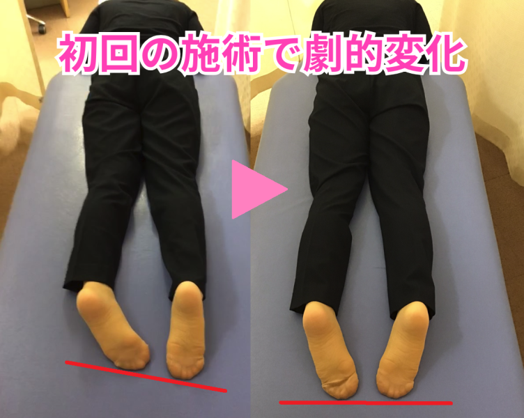 骨盤矯正BA